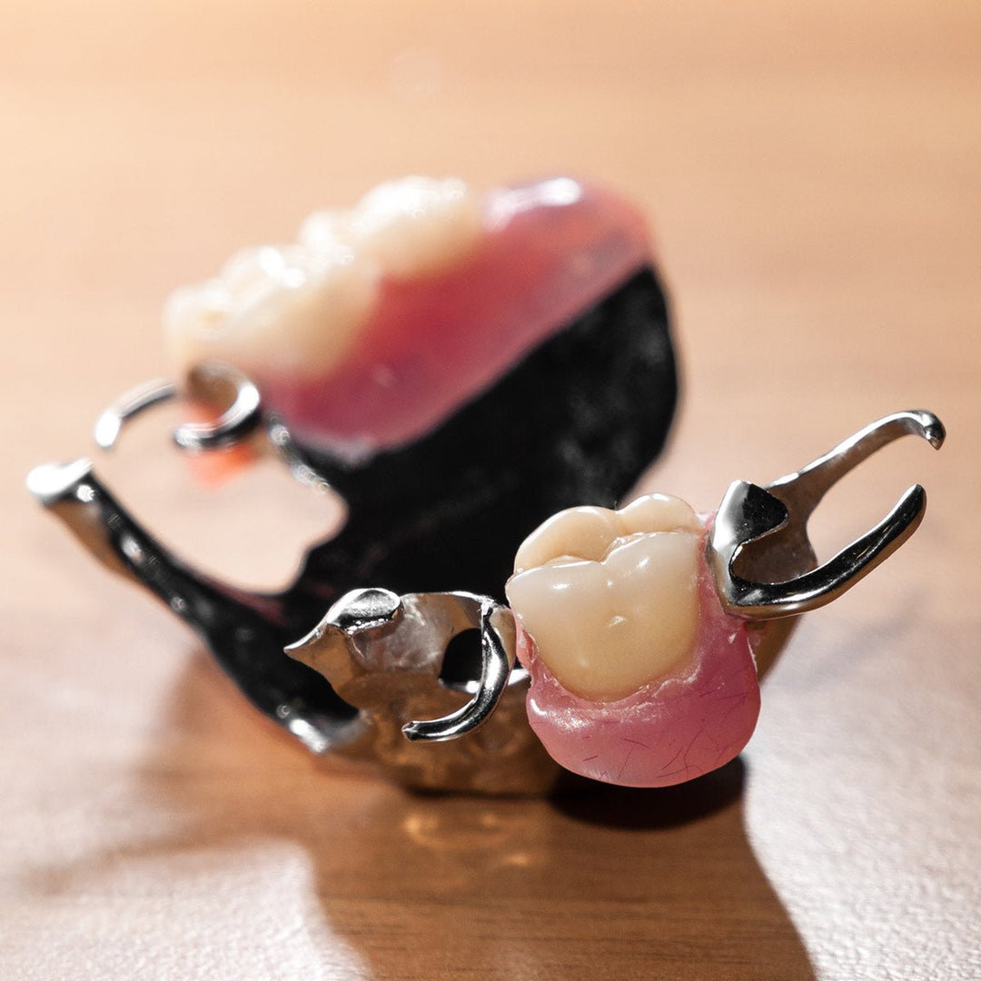 CAST Dental Investment Casting Resin - Monocure3D
