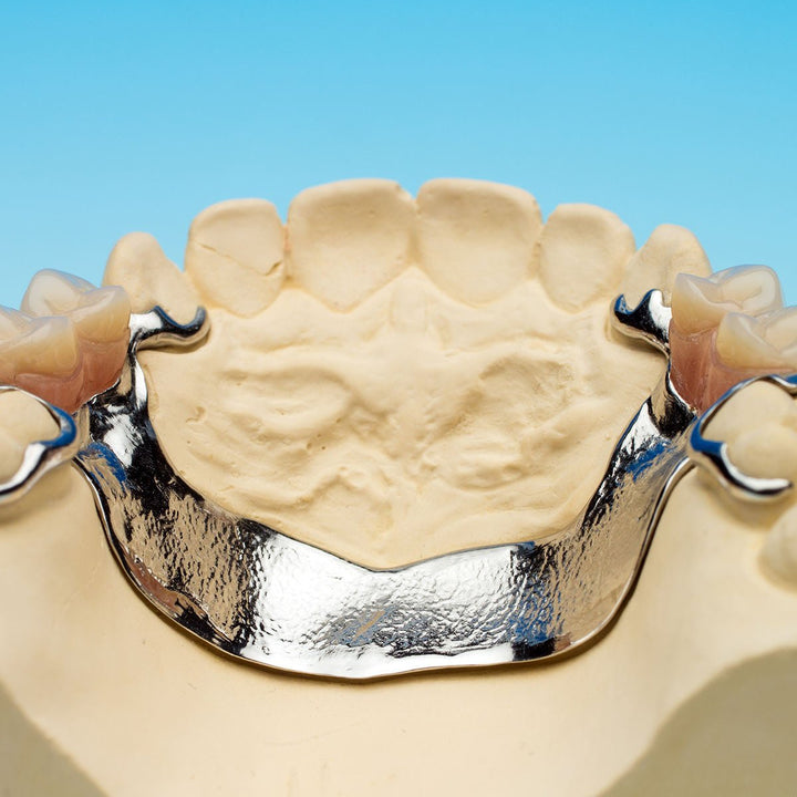 CAST Dental Investment Casting Resin - Monocure3D