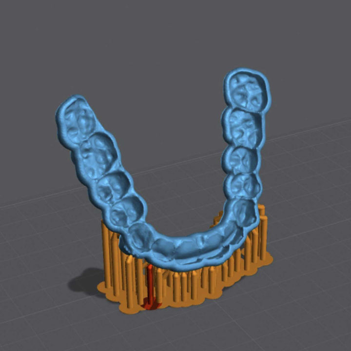 SPLINT Biocompatible Dental Resin - Monocure3D