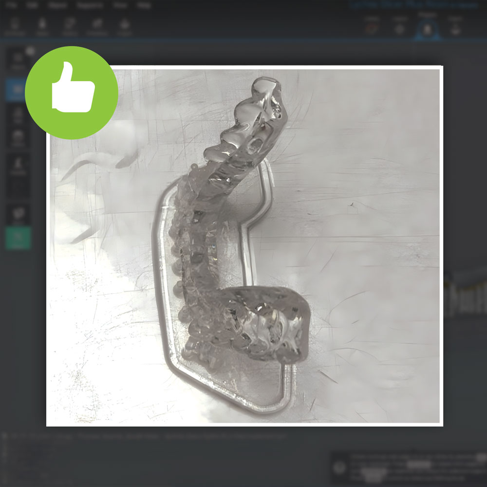 Successful dental model with correct support strategy